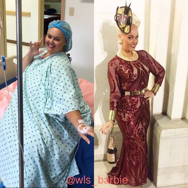 Barbie Fangirl Lost 82 Kilos To Look More Like Her Idol
