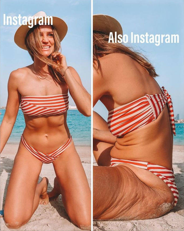 33-Year-Old Woman Shows What Hides Behind Instagram Photos