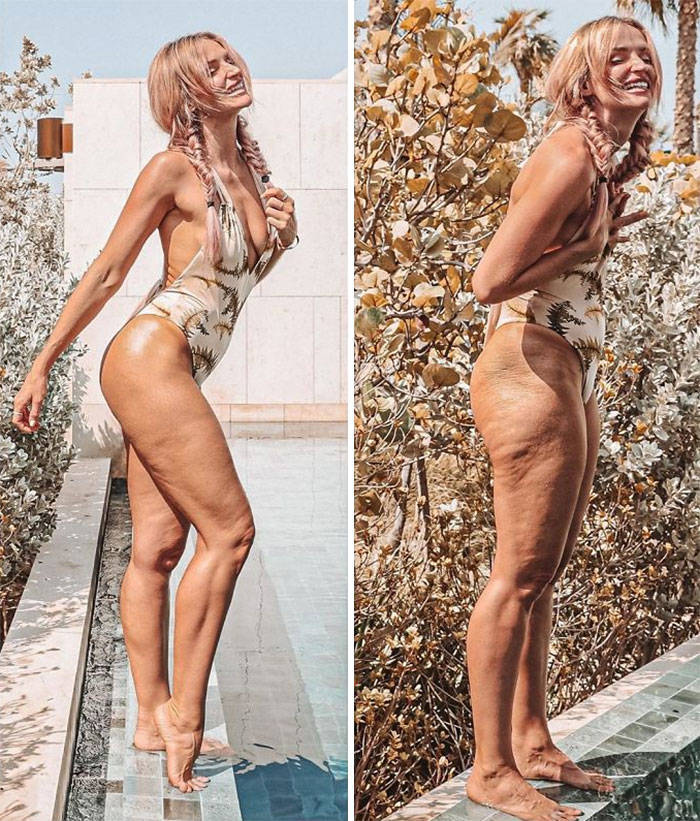 33-Year-Old Woman Shows What Hides Behind Instagram Photos