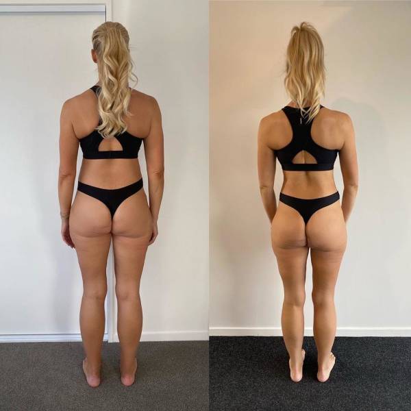 New Zealander Girl Showed How She Lost Almost 100 Kilograms!