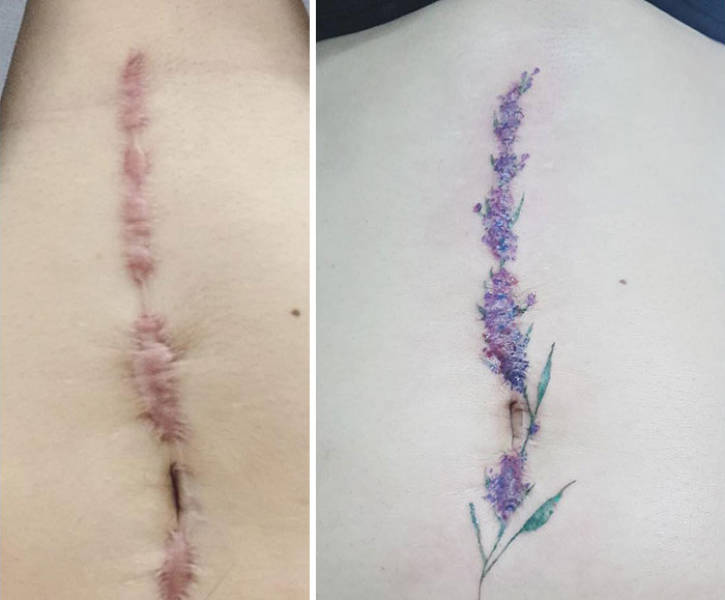This Tattoo Artist Knows How To Cover Scars And Make It Look Good