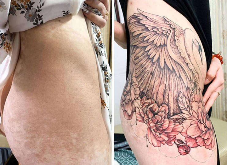 This Tattoo Artist Knows How To Cover Scars And Make It Look Good