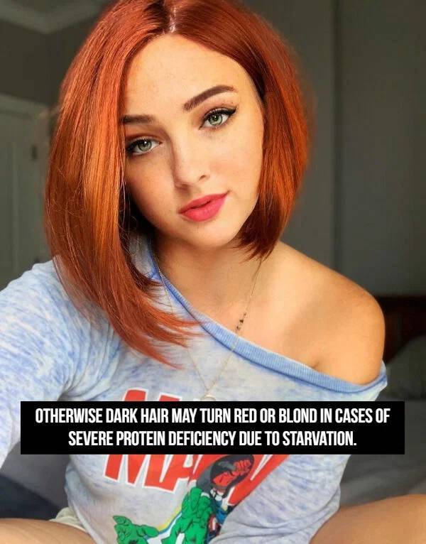 Flaming Facts About Redheads
