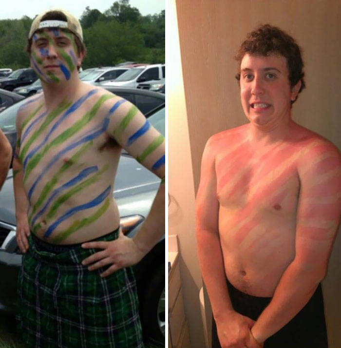 Never Forget Sunscreen!