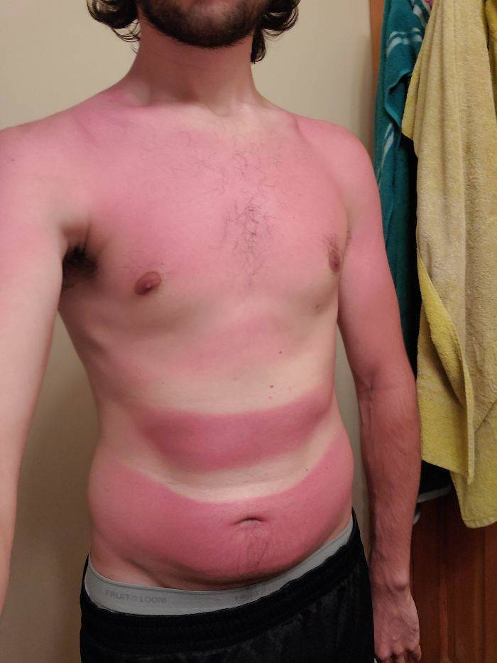 Never Forget Sunscreen!