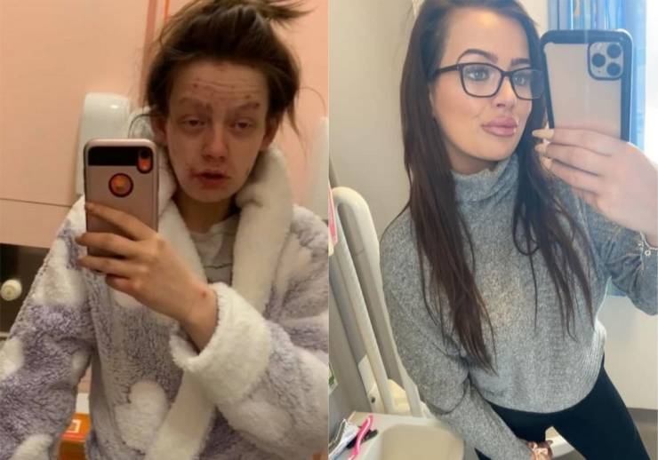 Former Heroin Addict Shares Photos Of Her Incredible Transformation