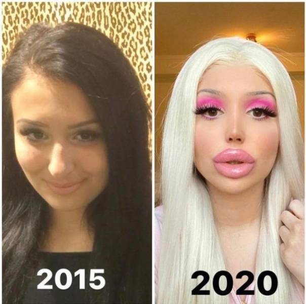 Plastic Surgery Is DEFINITELY Not For Everyone…