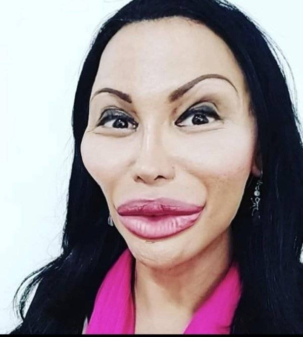 Plastic Surgery Is DEFINITELY Not For Everyone…