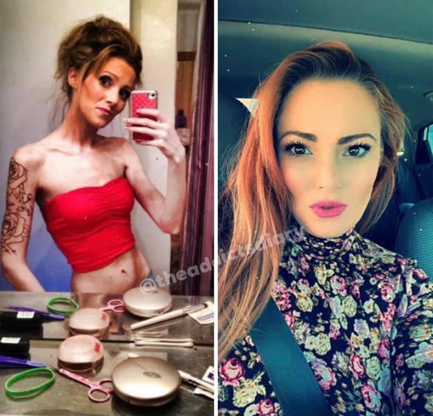 “The Addict’s Diary” Shows People’s Transformations After They Quit Drugs