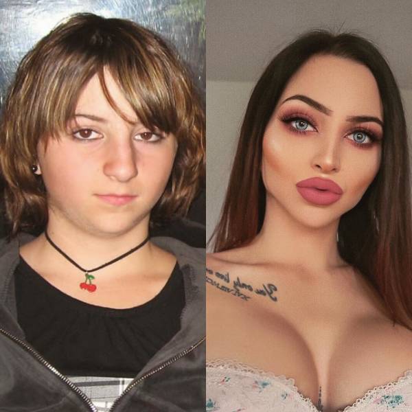 This Girl Got Bullied At School Because Of Her Appearance, So She Spent Thousands On Plastic Surgery