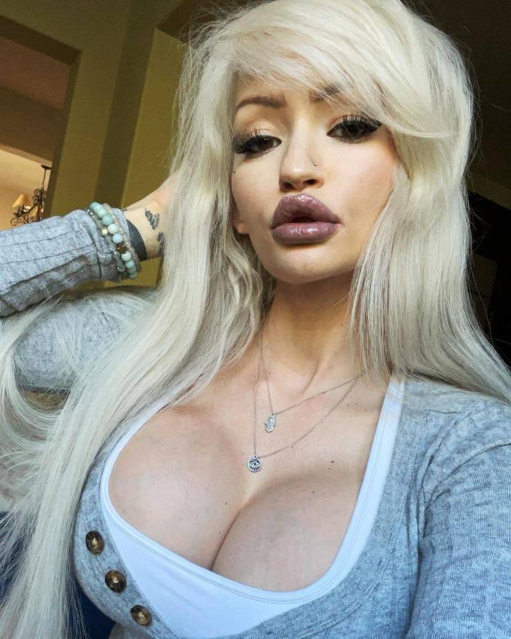 American Woman Enlarged Her Breasts And Became A Millionaire To Spite Her Former Classmates