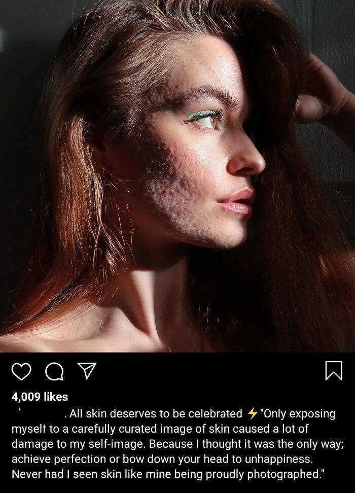 People Showing Their Real, Unedited Beauty