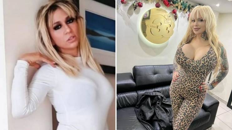 “Playboy” Model Went Through 53 Plastic Surgeries And Got Rewarded With A Paralyzed Face
