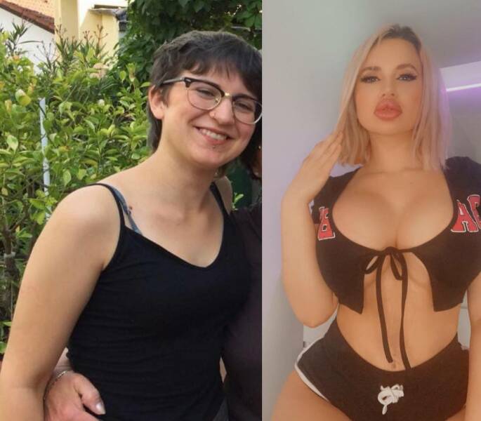German Woman Wants To Have World’s Biggest Boobs, Butt, And Lips
