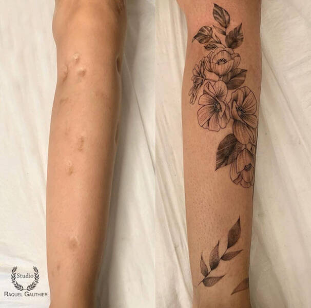 People Covering Their Scars In Cool Fashion