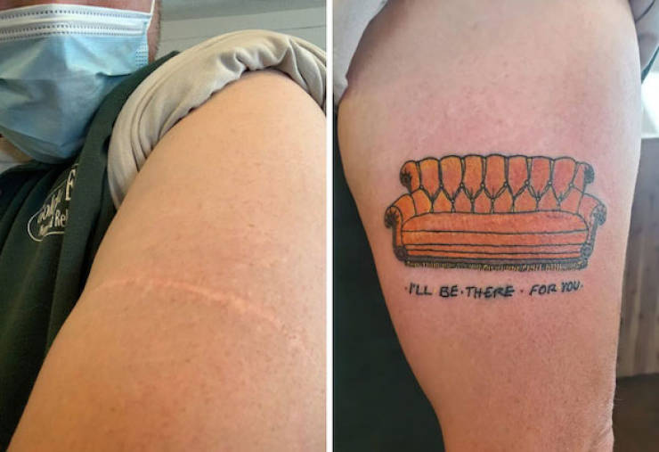 Tattoo Artists Covering Scars And Birthmarks