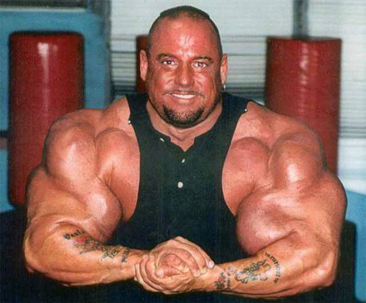 Synthol Does NOT Look Good, Guys…
