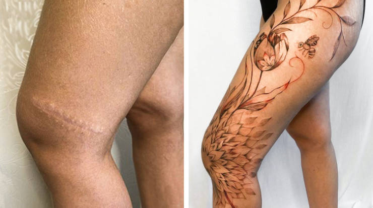 Artist Saves People’s Scars By Tattooing Over Them