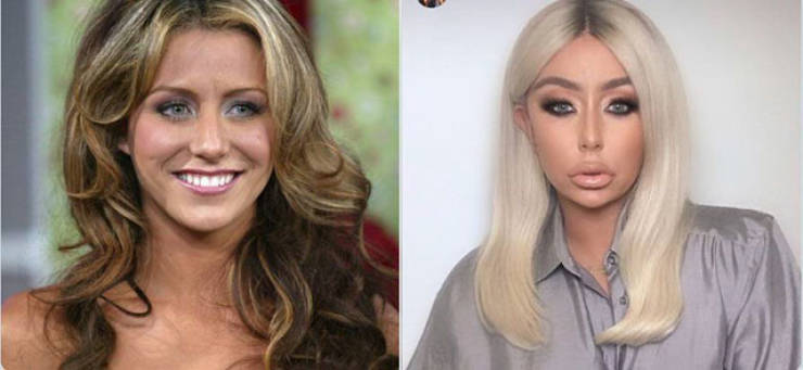 When Plastic Surgery Goes Too Far