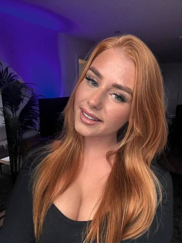 Freckle Fantasia: The Atomic Beauty Of Adorableness