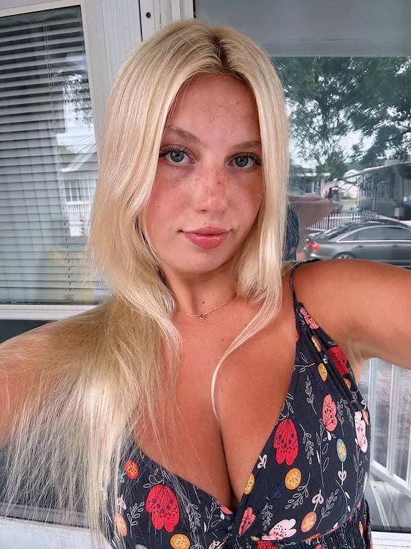 Freckle Fantasia: The Atomic Beauty Of Adorableness