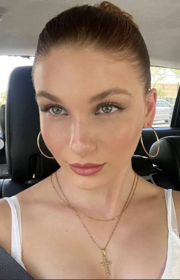 Freckle Fantasia: The Atomic Beauty Of Adorableness