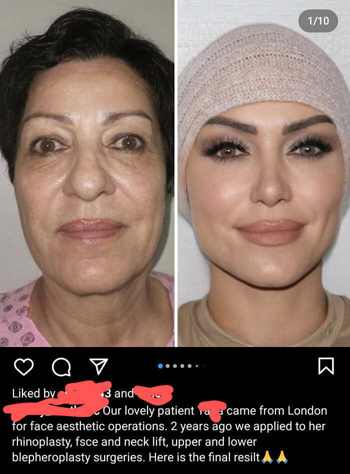 Instagram Vs. Reality Awkward Exposures