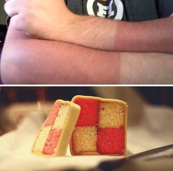 Sunburn Disasters That