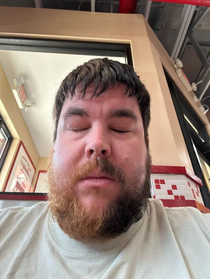 Extraordinary Body Features People Are Proud Of