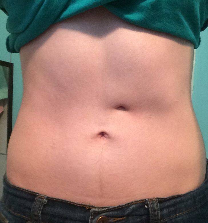 Extraordinary Body Features People Are Proud Of