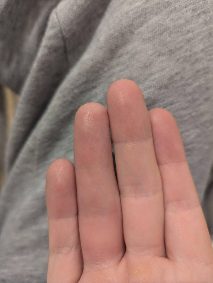 Extraordinary Body Features People Are Proud Of