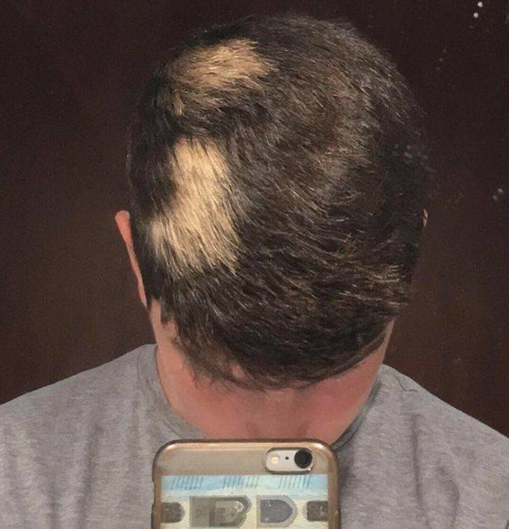 Extraordinary Body Features People Are Proud Of