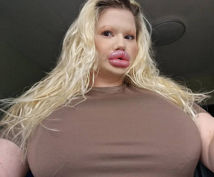 Andrea Ivanova: The Influencer Known For Her Extreme Lip Filler Addiction