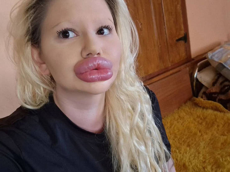 Andrea Ivanova: The Influencer Known For Her Extreme Lip Filler Addiction