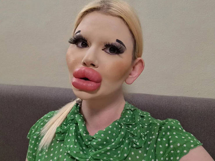 Andrea Ivanova: The Influencer Known For Her Extreme Lip Filler Addiction