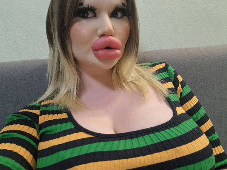Andrea Ivanova: The Influencer Known For Her Extreme Lip Filler Addiction