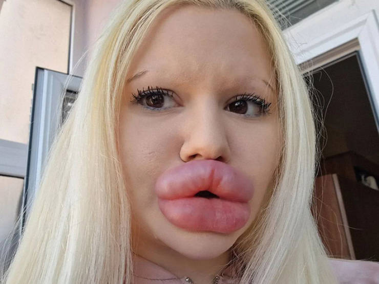 Andrea Ivanova: The Influencer Known For Her Extreme Lip Filler Addiction
