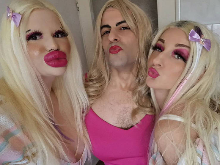 Andrea Ivanova: The Influencer Known For Her Extreme Lip Filler Addiction