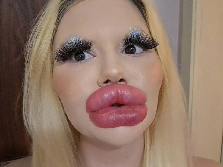 Andrea Ivanova: The Influencer Known For Her Extreme Lip Filler Addiction