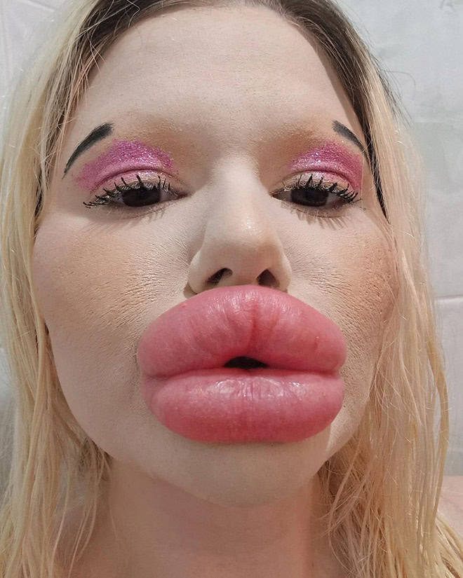 Andrea Ivanova: The Influencer Known For Her Extreme Lip Filler Addiction