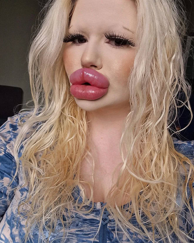 Andrea Ivanova: The Influencer Known For Her Extreme Lip Filler Addiction