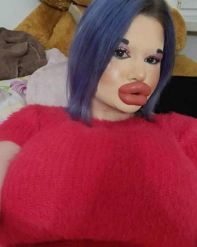 Andrea Ivanova: The Influencer Known For Her Extreme Lip Filler Addiction