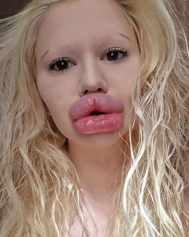 Andrea Ivanova: The Influencer Known For Her Extreme Lip Filler Addiction