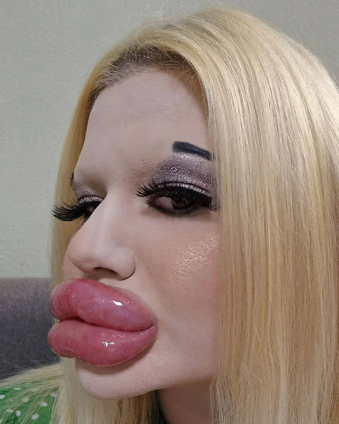 Andrea Ivanova: The Influencer Known For Her Extreme Lip Filler Addiction