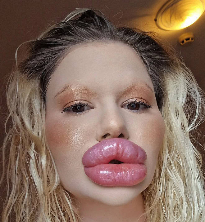 Andrea Ivanova: The Influencer Known For Her Extreme Lip Filler Addiction