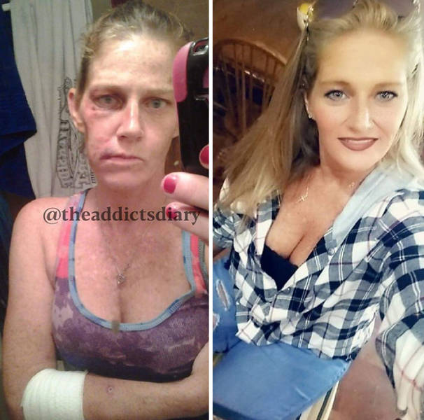 Remarkable Journeys Of Those Who Conquered Addiction And Transformed Their Lives
