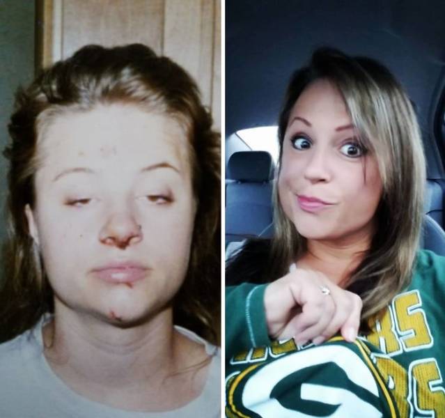 Remarkable Journeys Of Those Who Conquered Addiction And Transformed Their Lives
