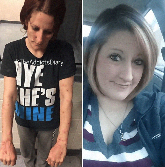 Remarkable Journeys Of Those Who Conquered Addiction And Transformed Their Lives