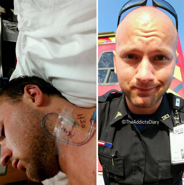 Remarkable Journeys Of Those Who Conquered Addiction And Transformed Their Lives