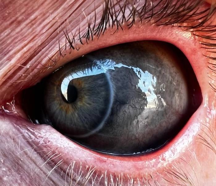 The Shocking Trend Of Eyeball Tattoos